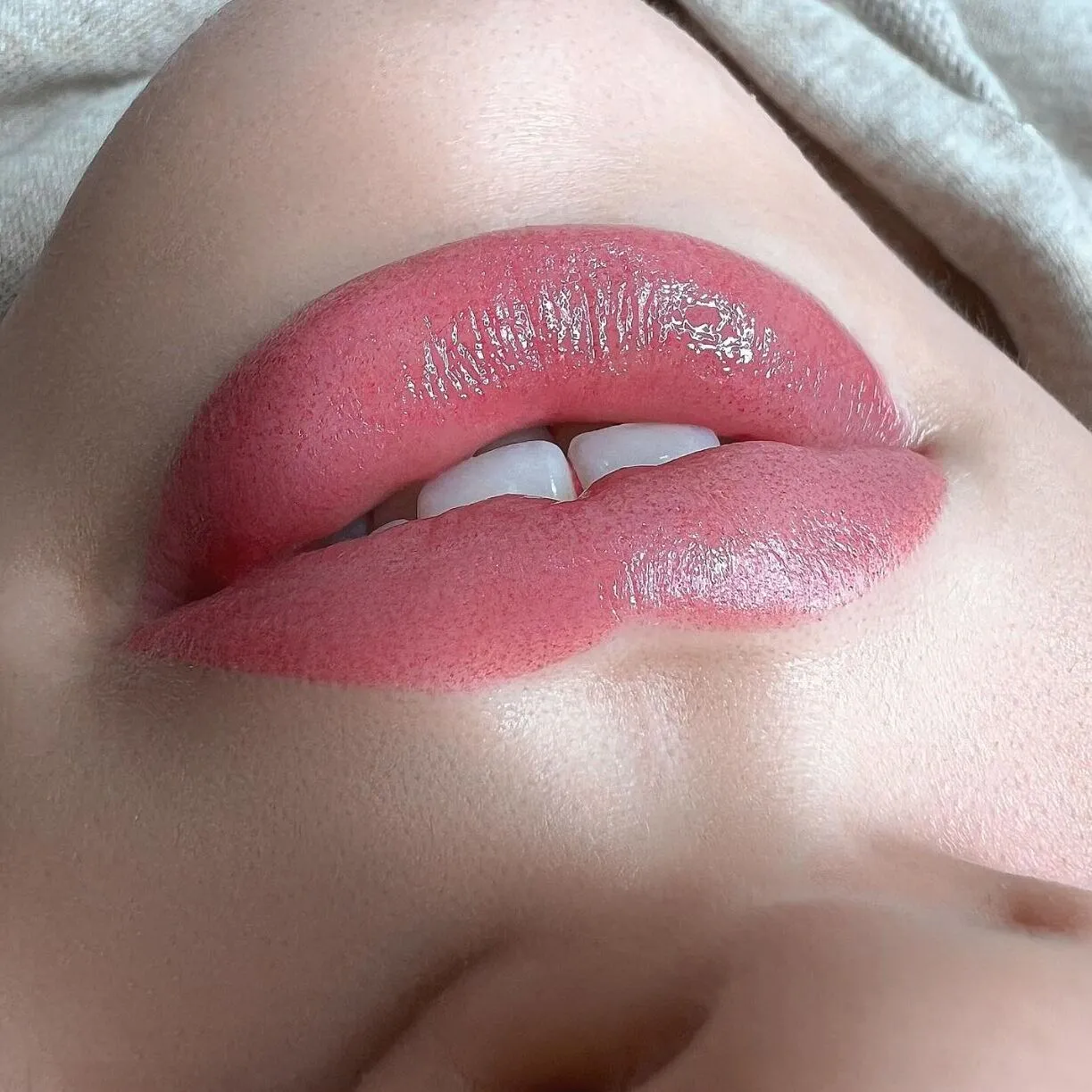 Post Procedure Aftercare