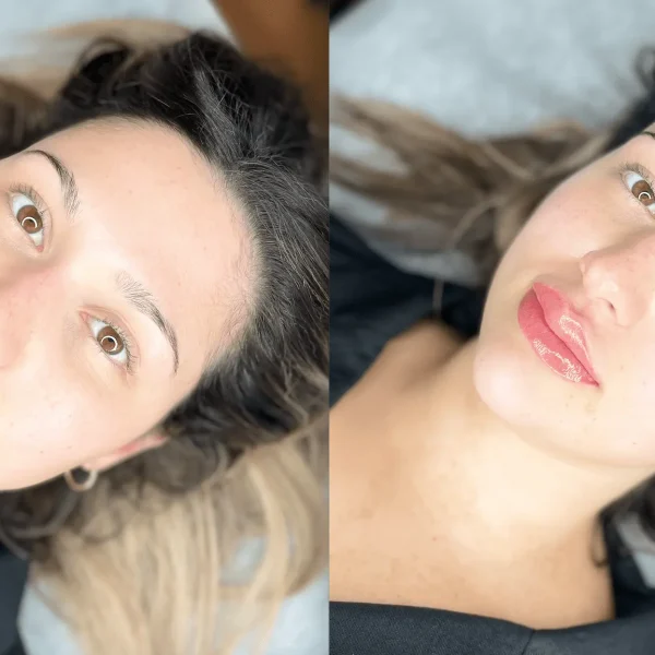 cosmetic lip tattooing